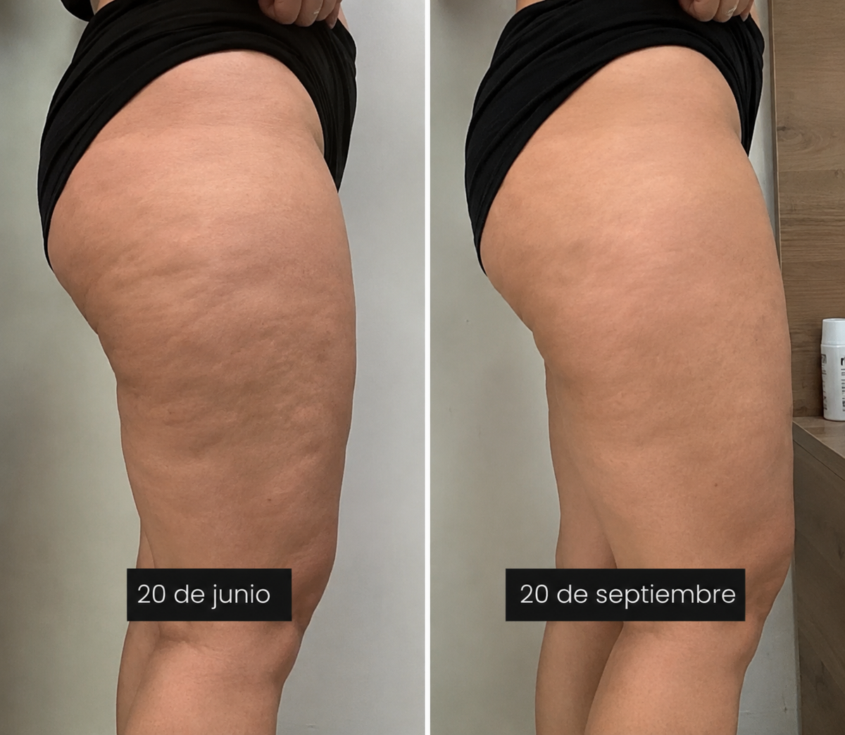 Volví a sentirme cómoda con mis piernas
