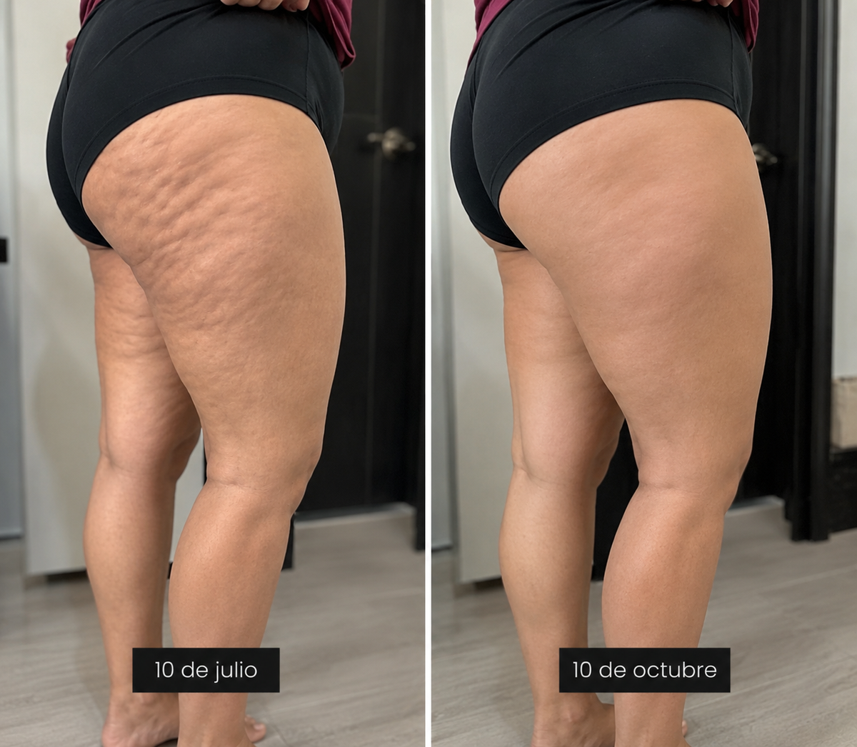 Por fin dejé de esconder mis piernas